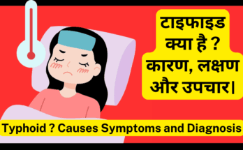 टाइफाइड-Typhoid क्या है कारण, लक्षण और उपचार। Typhoid Causes Symptoms and Best Diagnosis