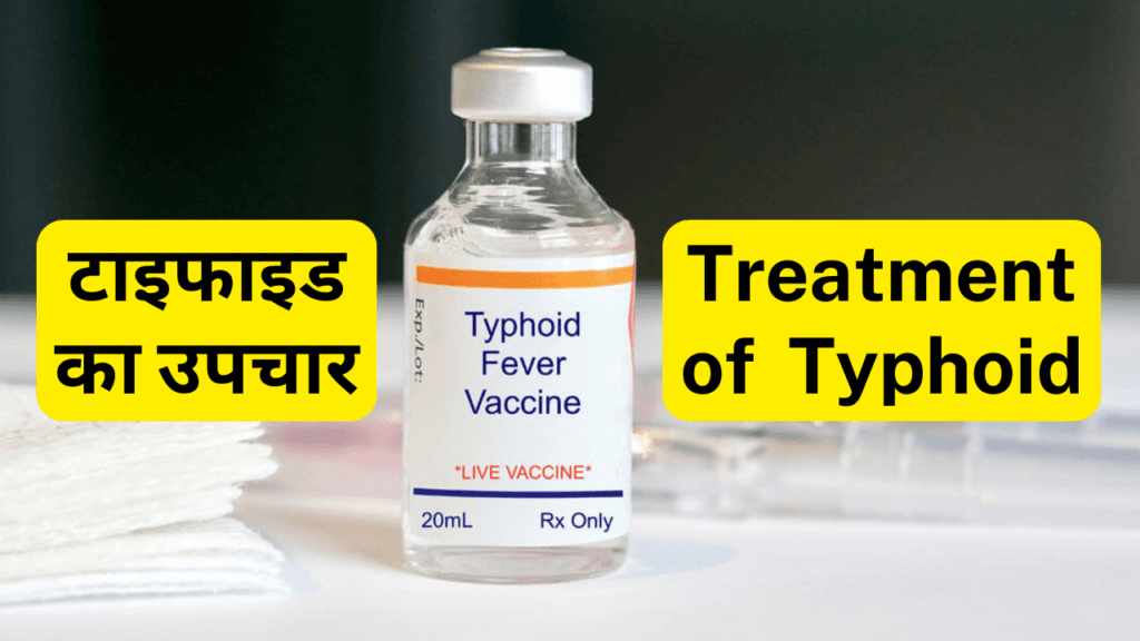 टाइफाइड-Typhoid क्या है कारण, लक्षण और उपचार। Typhoid Causes Symptoms and Best Diagnosis