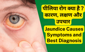 पीलिया-Jaundice रोग क्या है कारण, लक्षण और उपचार। Jaundice Causes Symptoms and Best Diagnosis
