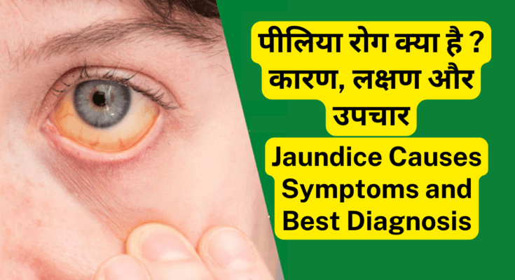 पीलिया-Jaundice रोग क्या है कारण, लक्षण और उपचार। Jaundice Causes Symptoms and Best Diagnosis