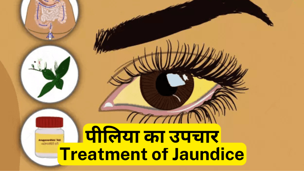 पीलिया-Jaundice रोग क्या है  कारण, लक्षण और उपचार। Jaundice Causes Symptoms and Best Diagnosis