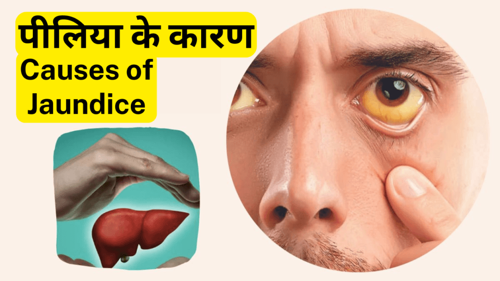 पीलिया-Jaundice रोग क्या है  कारण, लक्षण और उपचार। Jaundice Causes Symptoms and Best Diagnosis